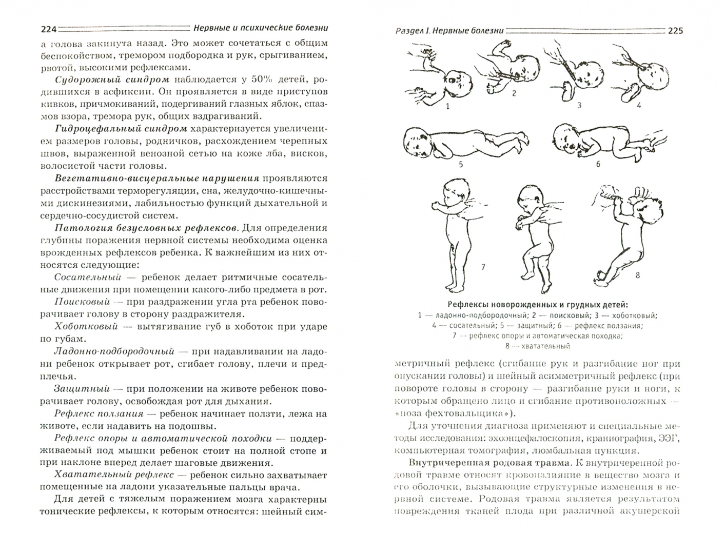 Нервные и психические болезни. Нервные и психические болезни Бортникова. Психические болезни книга. Цепные шейные и туловищные установочные рефлексы. Нервные болезни Зубахина.