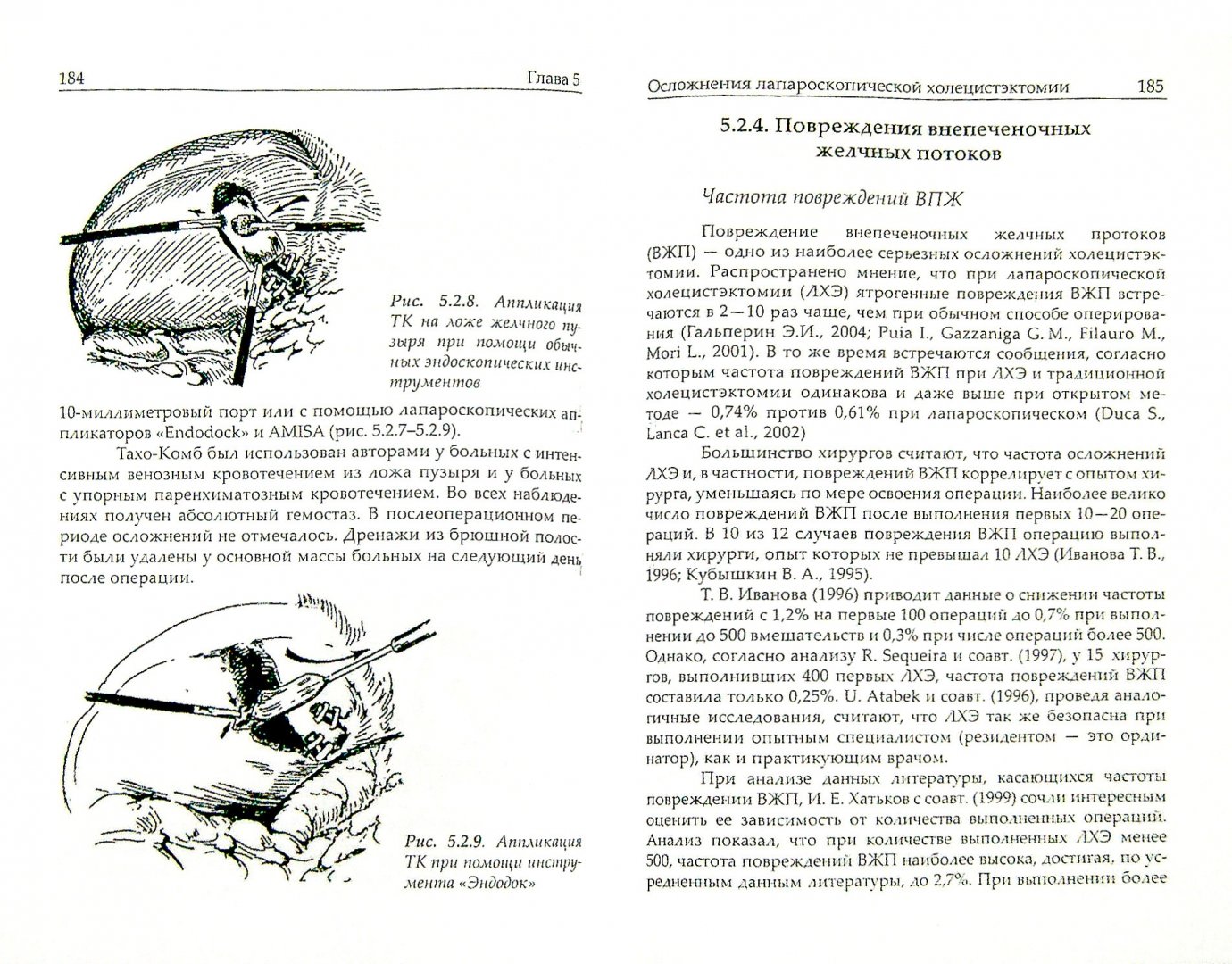 Операция желчнокаменной болезни